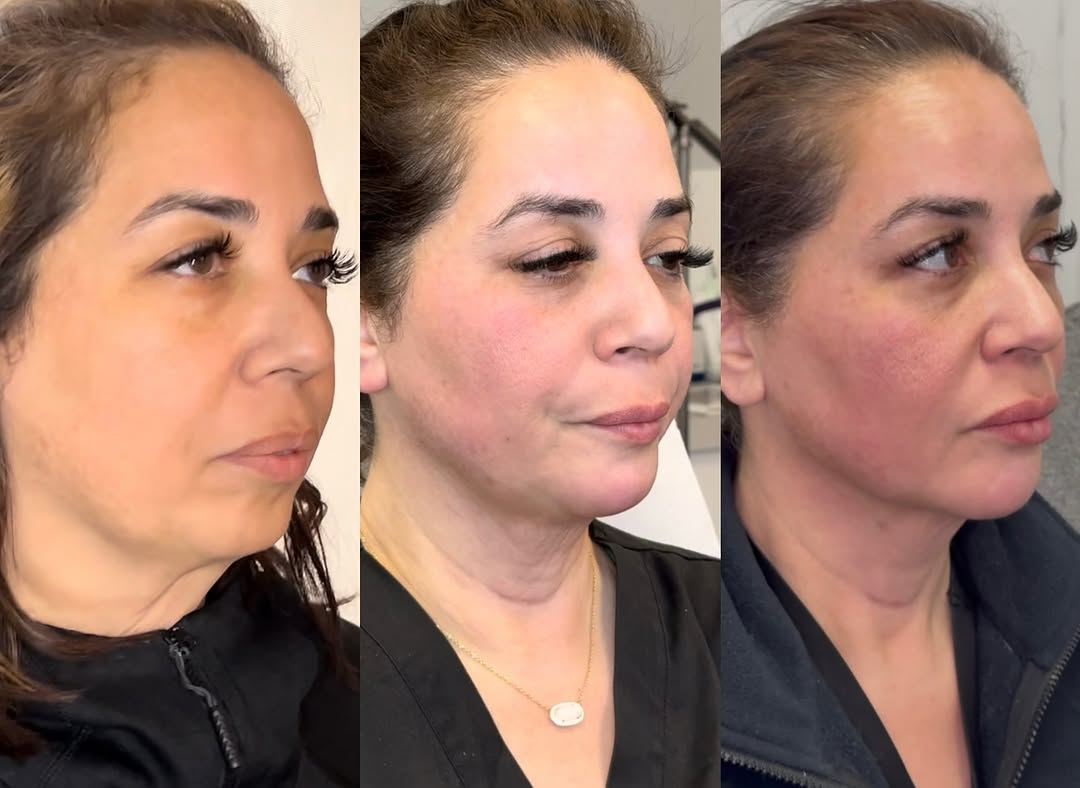 Two-year transformation, before and after, a patient of Dr. Adam Mauer