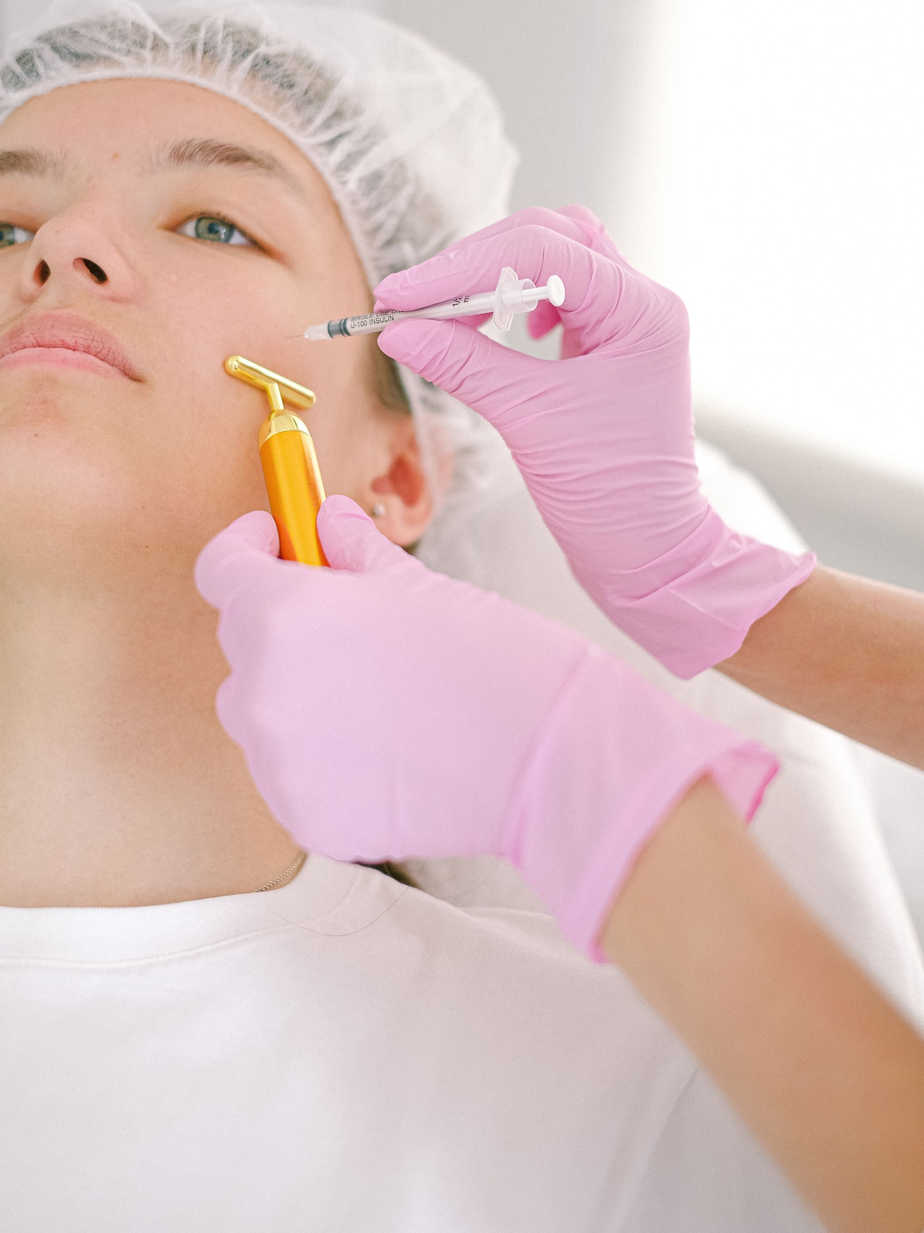 Microneedling